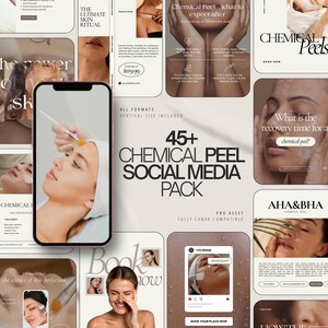Szablony na Instagram z peelingiem chemicznym | Branding Canva do pielęgnacji skóry | Posty na Instagram z peelingiem chemicznym | Szablon do mediów społecznościowych z peelingiem chemicznym