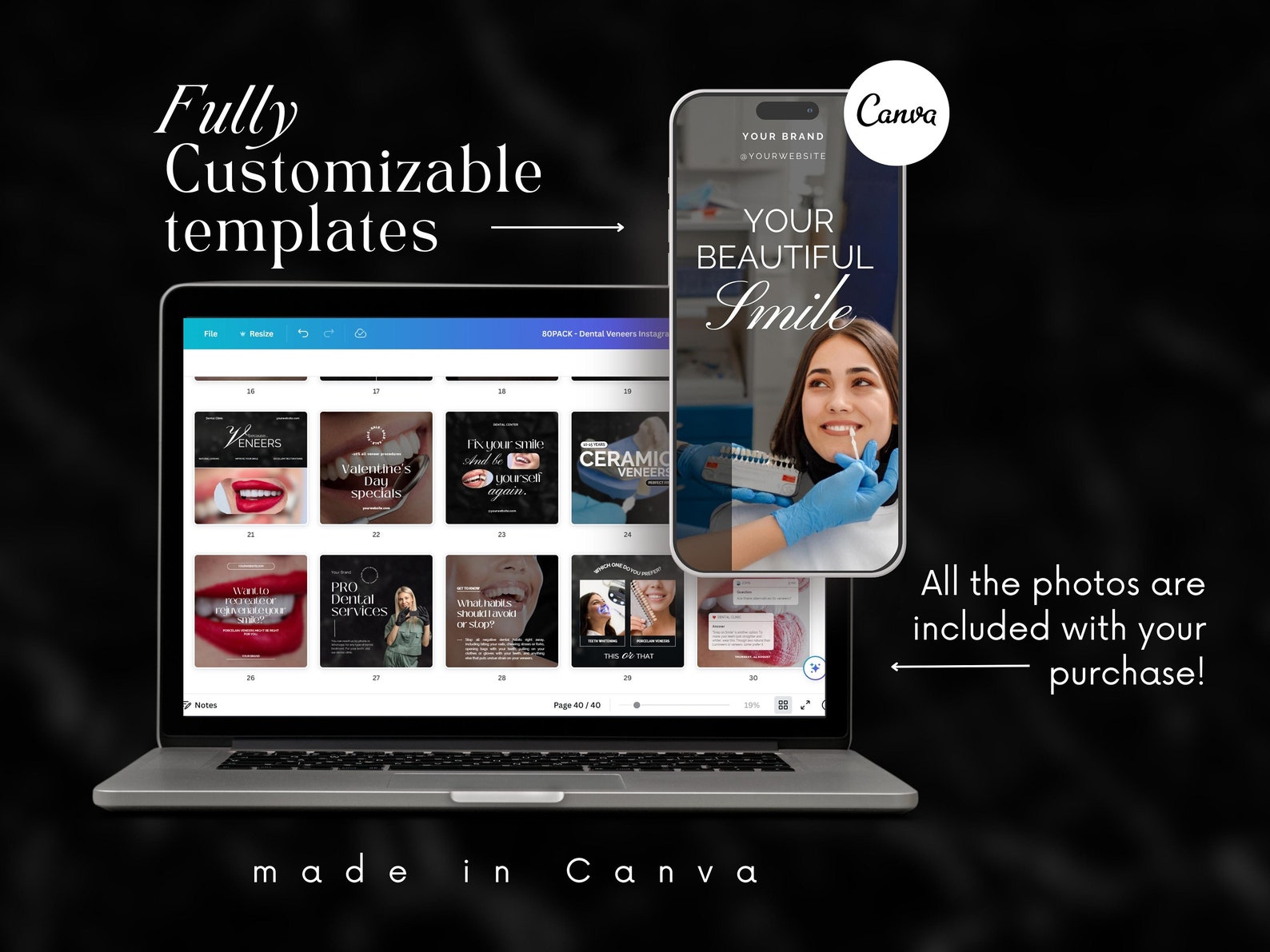 80 Dental Veneers Instagram Templates Luxury Teeth Veneers Etsy