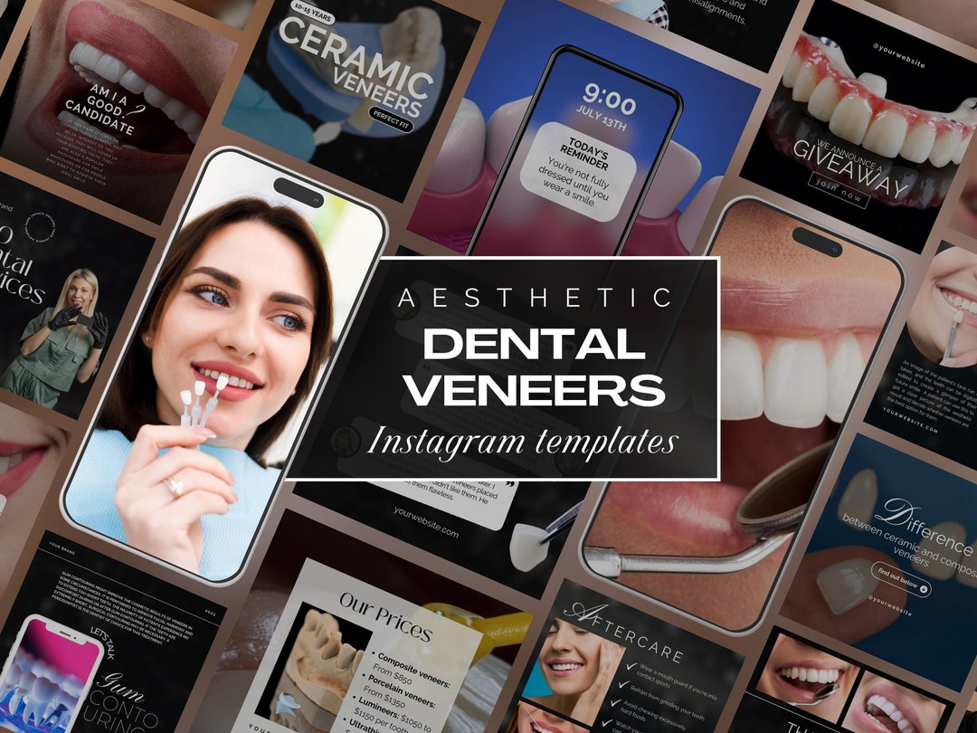 80 Dental Veneers Instagram Templates Luxury Teeth Veneers Etsy