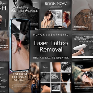 Laser Tattoo Removal Instagram Template | Tattoo Removal Posts | Tattoo Removal Canva Template | Tattoo Artist Template