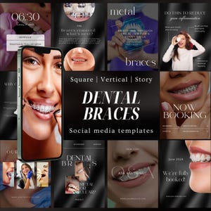 Dental Braces Instagram Templates | Braces Instagram Posts | Orthodontist Instagram Branding | Teeth Care Template | Canva Braces Posts