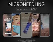 microneedling instagram reel videos | skincare templates (Canva) | videos for skincare specialist | microneedling social media videos