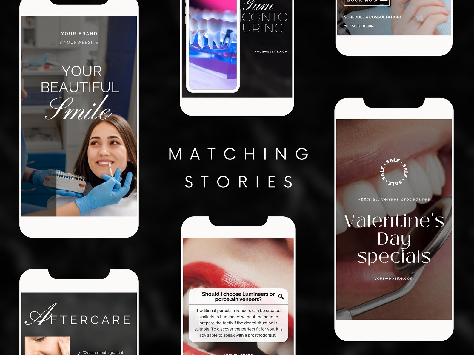80 Dental Veneers Instagram Templates Luxury Teeth Veneers Etsy