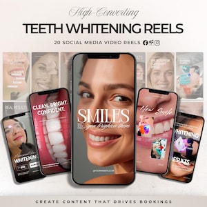 Puede incluir: Imagen promocional de servicios de blanqueamiento dental. La imagen presenta a una mujer sonriendo con dientes blancos brillantes, rodeada de teléfonos inteligentes que muestran resultados de antes y después y el texto "High-Converting TEETH WHITENING REELS". También es visible el texto "SMILES you brighten them".