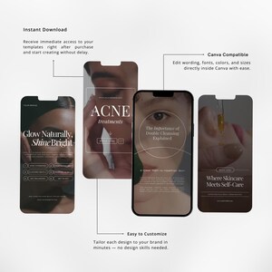 skincare instagram videos | skincare instagram video reels | skincare video template | skincare canva template image 4