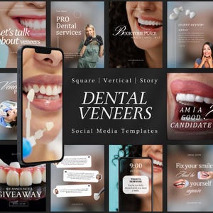Instagram Vorlagen für Zahnveneer | Zahnarzt Leinwand Branding | Zahnverblendungen Social-Media-Posts | zahnKlinik Vorlage