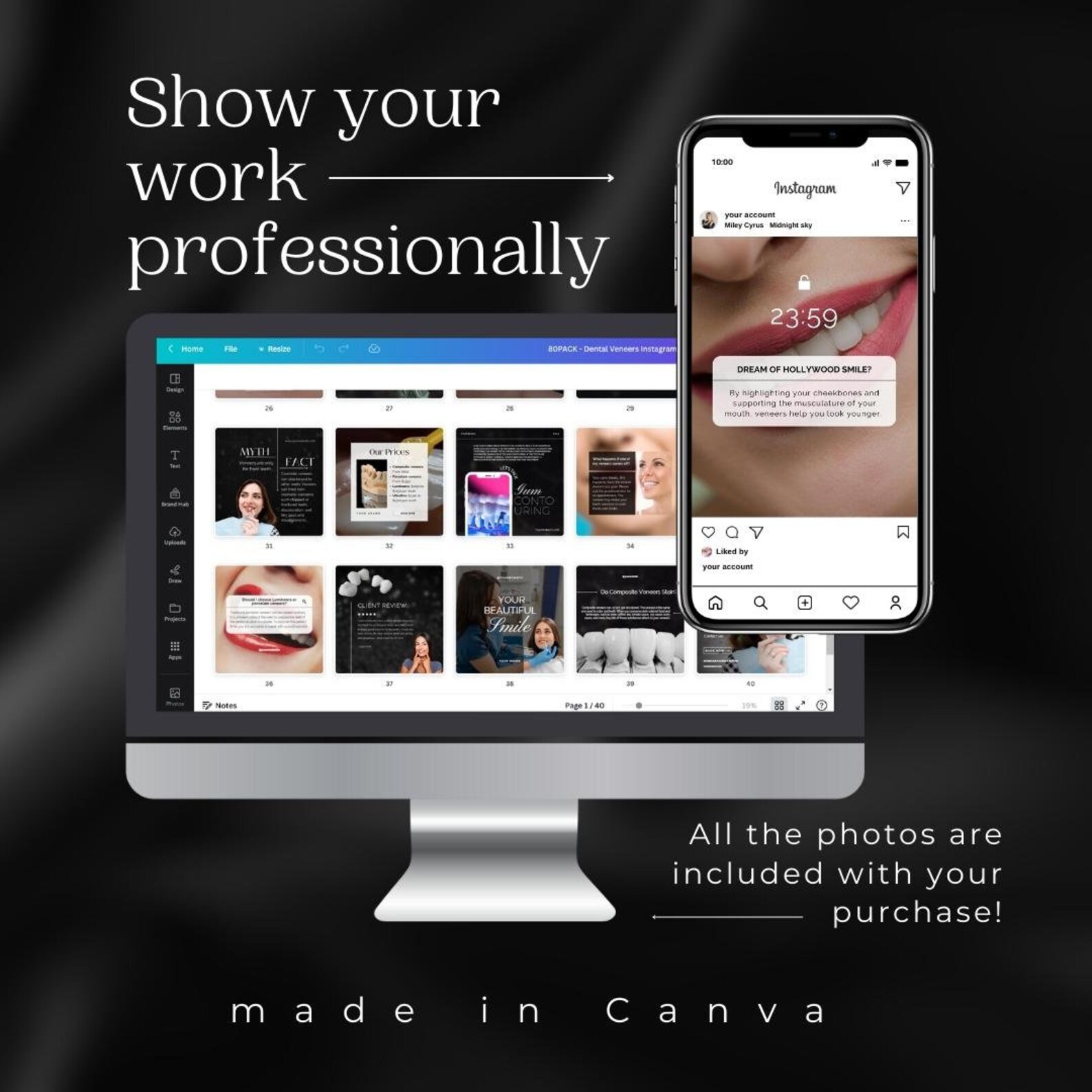 80 Dental Veneers Instagram Templates Luxury Teeth Veneers Etsy