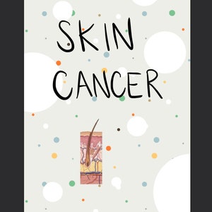 Skin Cancer Study Guide