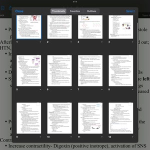 Puede incluir: Una tableta digital muestra un documento con miniaturas de varias páginas. El documento parece ser una guía de estudio médica, con notas manuscritas y diagramas. La pantalla muestra las palabras "Perfusion-Shock" y "Team Work/Code Roles".