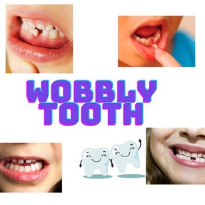 wobbly tooth, autism social story for anxious child