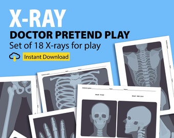 Druckbare Röntgenbilder für Kinder, Pretend Play Ärzte, Pretend Play Krankenschwestern, Krankenhaus Pretend Play, Doktor Dramatic Play, Kleinkind Pretend Play