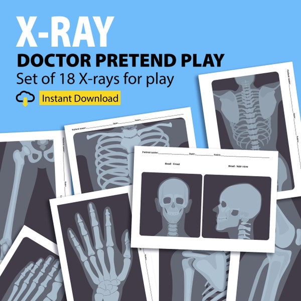 Afdrukbare röntgenfoto's voor kinderen, fantasiespel artsen, fantasiespel verpleegsters, ziekenhuis fantasiespel, dokter dramatisch spel, peuter fantasiespel