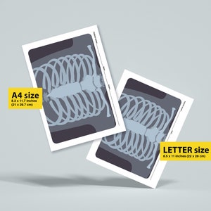 Printable X-rays for Kids, Pretend Play Doctors, Pretend Play Nurses ...