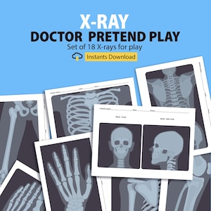 Printable X-Rays for kids, Pretend Play Doctors, Pretend play Nurses, Hospital Pretend Play, Doctor Dramatic Play, Toddler Pretend Play