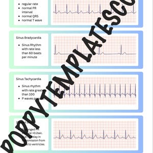 May include: A medical chart with four sections detailing heart rhythms. The top section shows a normal sinus rhythm with a regular rate. Other sections illustrate sinus bradycardia, sinus tachycardia, and 1st-degree heart block, each with corresponding ECG waveforms.