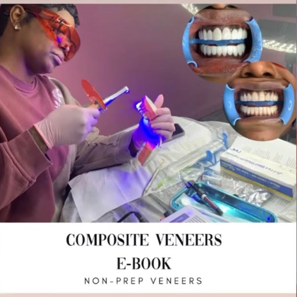 Composite Veneers Step by Step E-Book Plus Full Supplies list! & Full Step by Step Video!