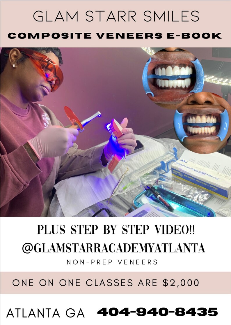 Composite Veneers Step by Step Ebook Plus Full Supplies List Etsy