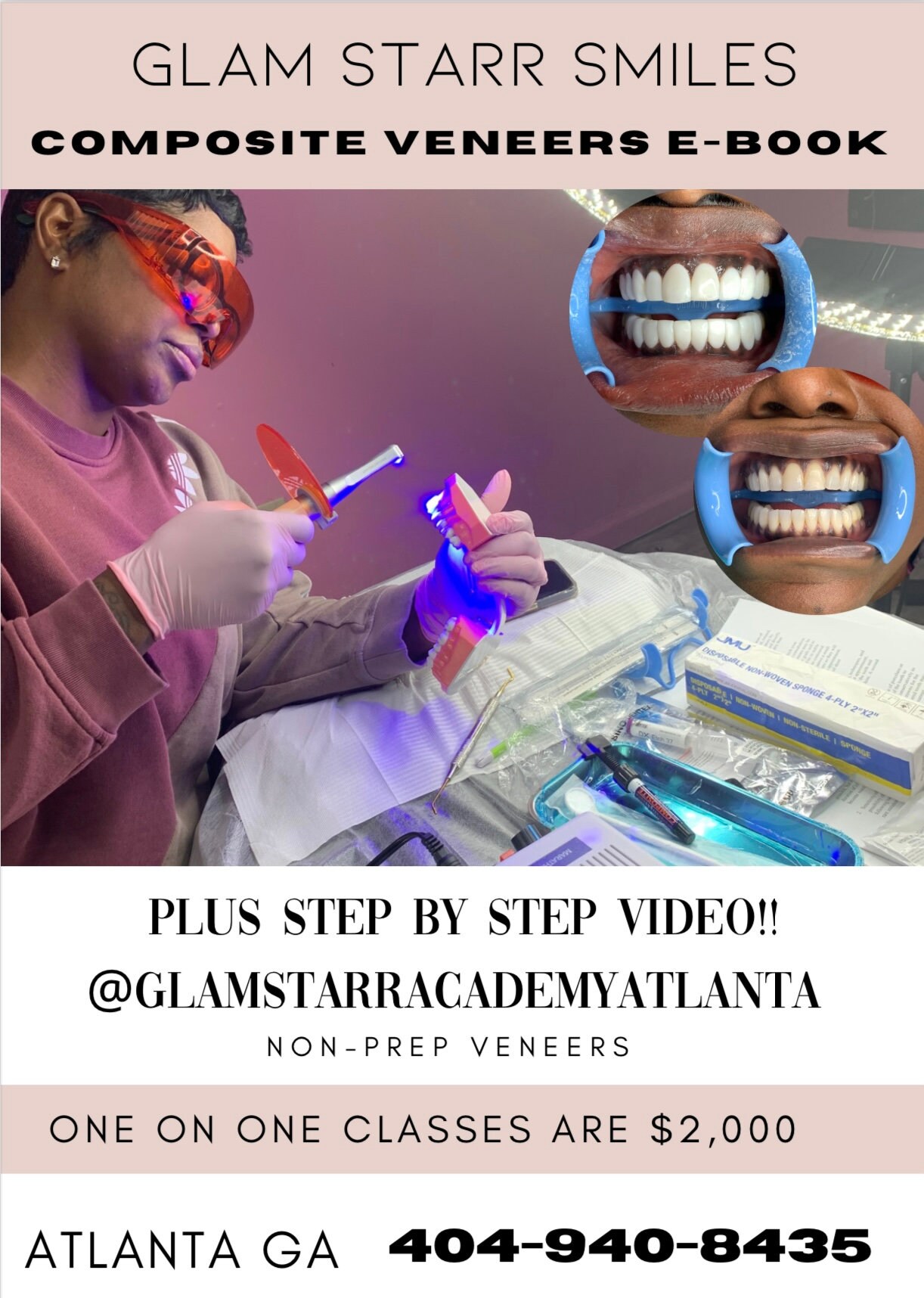 Composite Veneers Step by Step E-book Plus Full Supplies List - Etsy