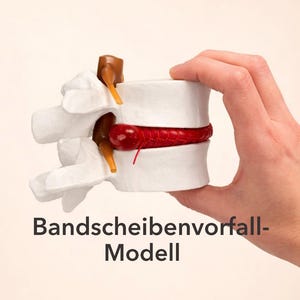 Puede incluir: Modelo de hernia discal, sostenido por una mano. El modelo muestra vértebras blancas, un disco rojo y ligamentos marrones. El texto "Bandscheibenvorfall-Modell" está en la parte inferior.
