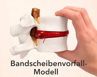 Bandscheibenvorfall-Modell