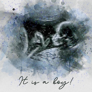 Arte de acuarela de ecografía de bebé personalizado: impresión de ecografía, regalo de embarazo, idea para revelar el género, regalo de baby shower, recuerdo de retrato digital