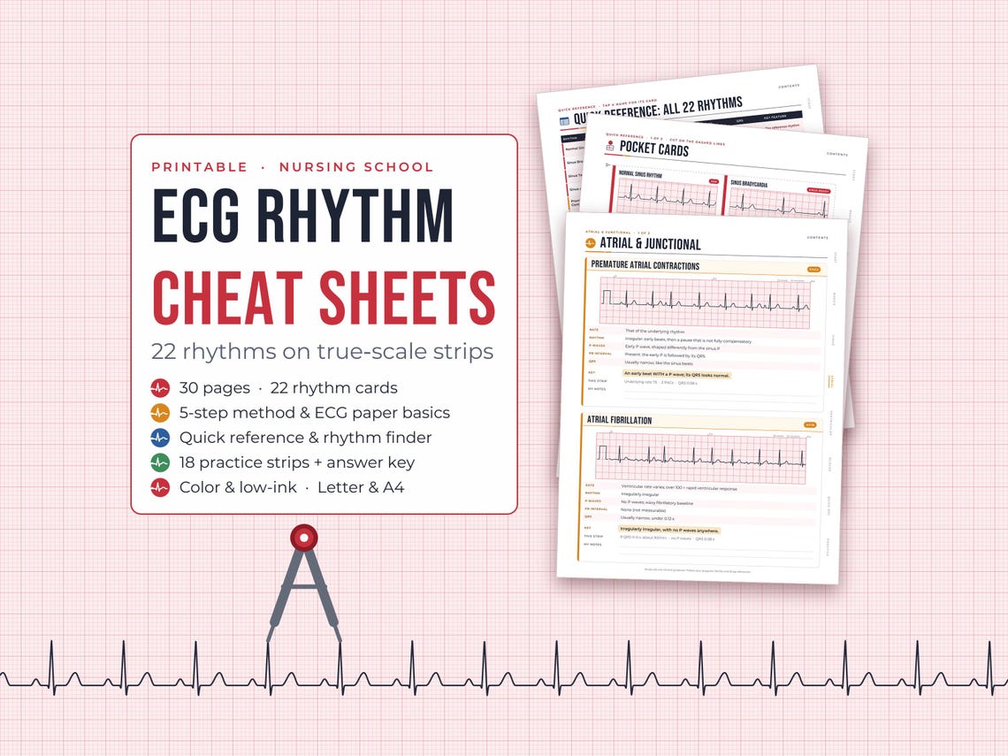 ECG Rhythm Cheat Sheets