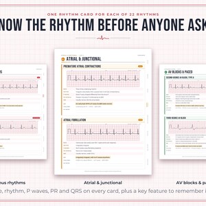 May include: A set of educational reference cards titled Know the Rhythm Before Anyone Asks, featuring ECG tracings for Sinus Rhythms, Atrial & Junctional rhythms, and AV Blocks & Paced rhythms, with detailed clinical data for each cardiac pattern.