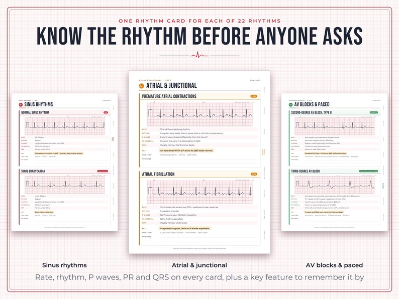 May include: A set of educational reference cards titled Know the Rhythm Before Anyone Asks, featuring ECG tracings for Sinus Rhythms, Atrial & Junctional rhythms, and AV Blocks & Paced rhythms, with detailed clinical data for each cardiac pattern.