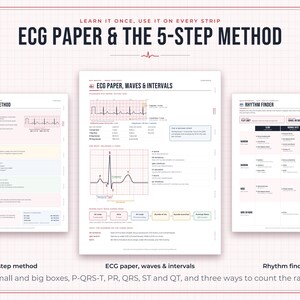 May include: Three educational reference sheets titled ECG Paper & The 5-Step Method, ECG Paper, Waves & Intervals, and Rhythm Finder. The documents feature diagrams, charts, and text explaining cardiac rhythm analysis and ECG measurements.