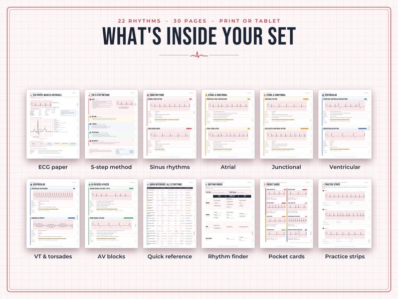 May include: A 30-page ECG study set featuring 22 rhythms, titled WHAT'S INSIDE YOUR SET. Includes pages for ECG paper, 5-step method, sinus rhythms, atrial, junctional, ventricular, VT and torsades, AV blocks, quick reference, rhythm finder, pocket cards, and practice strips.