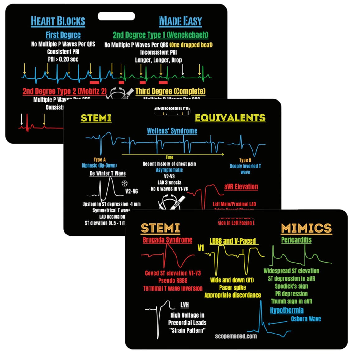 EKG Badge Card Set: STEMI, Heart Blocks, Equivalents - Nurse Study ...