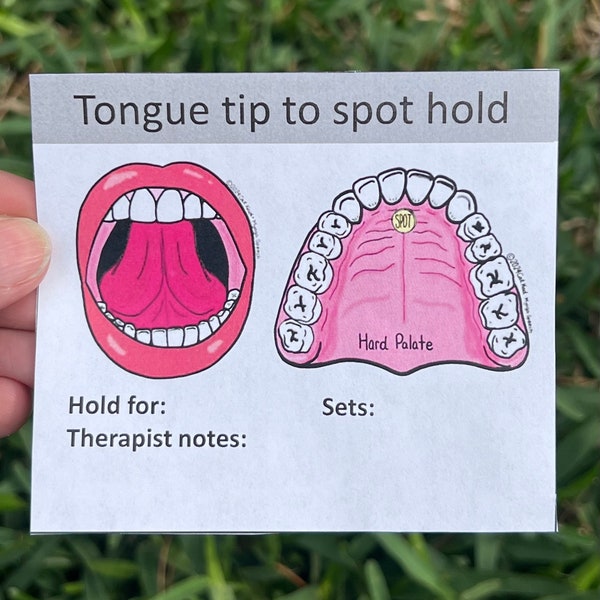 Tongue Myofunctional Therapy exercise cards PDFs FREE coloring page download this weekend only