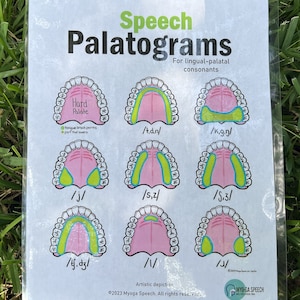 Palatograma IPA (1 página) de consoantes Língua-Palatal TABELA (download de PDF)