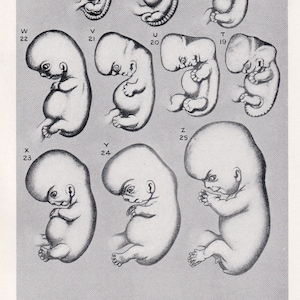 1934 MENSCHLICHER EMBRYO Druck - Schwangerschaft Druck - Original Vintage Druck - Baby Druck - Medizinisch - Muttertag - 89 Jahre alt - 9,15 x 6 Zoll