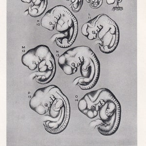 1934 MENSCHLICHER EMBRYO Druck - Schwangerschaft Druck - Original Vintage Druck - Baby Druck - Medizinisch - Muttertag - 89 Jahre alt - 9,15 x 6 Zoll