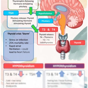 May include: An illustrated diagram detailing hypothyroidism and hyperthyroidism. The image shows the brain, pituitary, and thyroid glands, with arrows indicating hormone pathways. Text includes "Thyroid crisis 'Storm'" and lists symptoms. The diagram is educational.