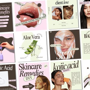 Skincare Instagram, Esthetician Instagram, Skincare Instagram Templates, Skincare Posts, Esthetician Templates, Skincare Social Media