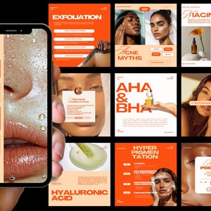 Skincare Instagram, Esthetician Instagram, Skincare Instagram Templates, Skincare Posts, Esthetician Templates, Skincare Social Media