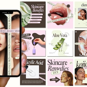 Skincare Instagram, Esthetician Instagram, Skincare Instagram Templates, Skincare Posts, Esthetician Templates, Skincare Social Media