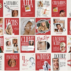 Skincare Instagram, Esthetician Instagram, Skincare Instagram Templates, Skincare Posts, Esthetician Templates, Skincare Social Media
