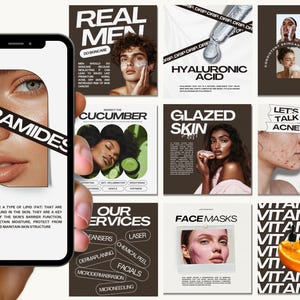 Skincare Instagram, Esthetician Instagram, Skincare Instagram Templates, Skincare Posts, Esthetician Templates, Skincare Social Media