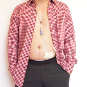 Peritoneal Dialysis Transfer set Holder with Adjustable necklace - Customized for Smaller PD Transfer Set