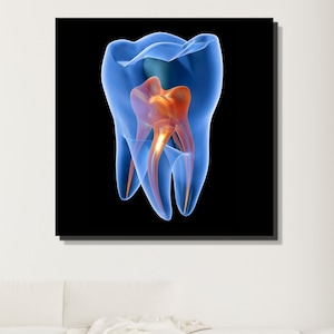 X-ray Molar Tooth Canvas|Dental Clinic Decor|Gift for Dentist|Abstract Teeth Canvas|Dental Art|Dental Wall Art|Teeth Decor|Dental Office Art