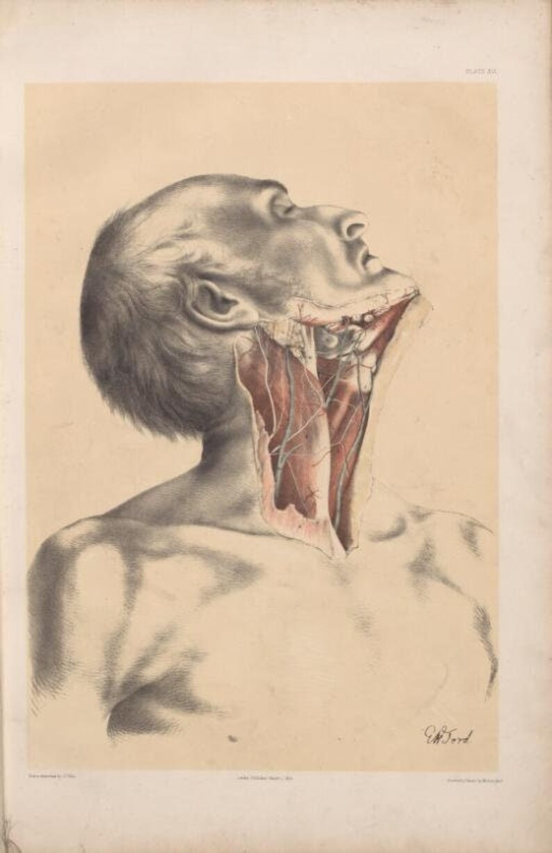 Vintage Illustration Dissection Showing the Surface View of - Etsy