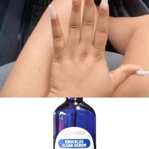 May include: A blue bottle of CocoGlow Knuckles Clear Serum. The bottle has a white label with blue text. The image also shows a hand with long, white fingernails.