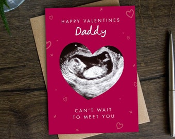 Daddy to be Valentinstag Karte, Foto Download, personalisierte Karte für Mann, Partner, Freund, Schwangerschaft, Ultraschall