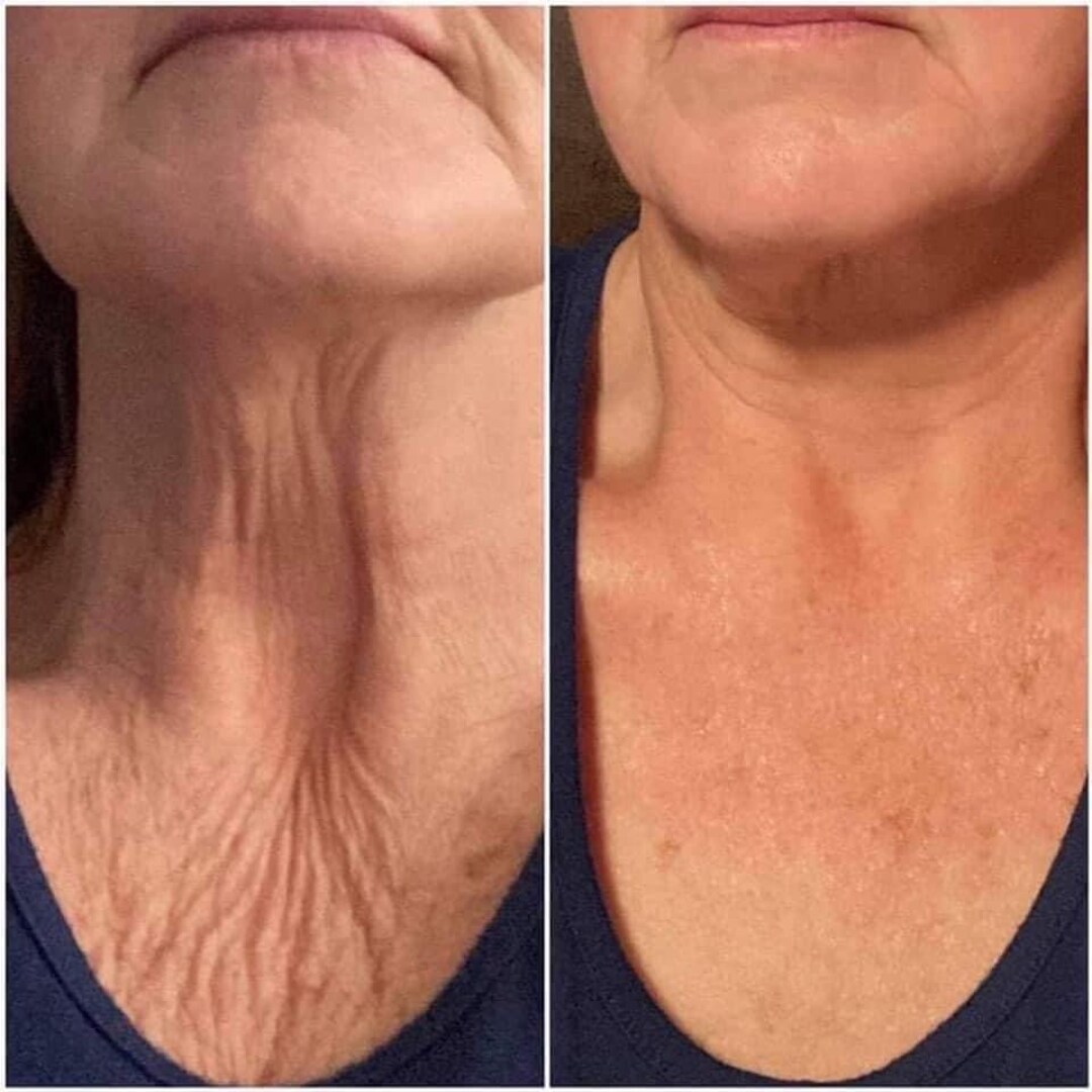 Nu Skin Ageloc Dermatic Effects Body Firming Lotion /hibiscus Firming