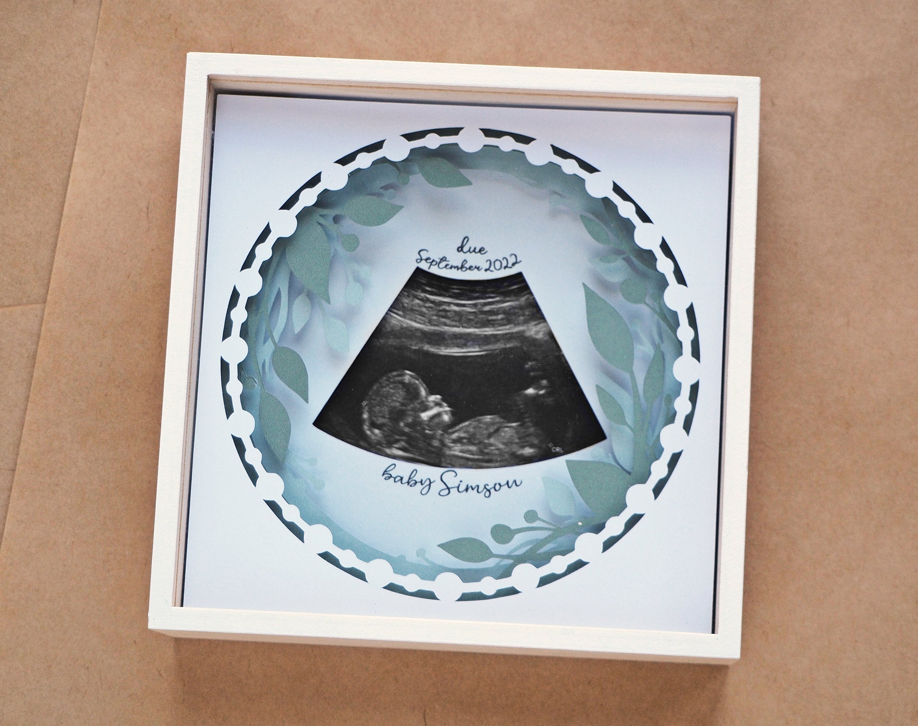Ultrasound Picture Frame, 3D Baby Scan Picture Shadow Box, Baby ...