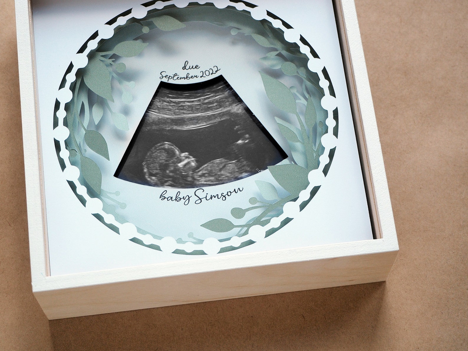 Ultrasound Picture Frame, 3D Baby Scan Picture Shadow Box, Baby ...