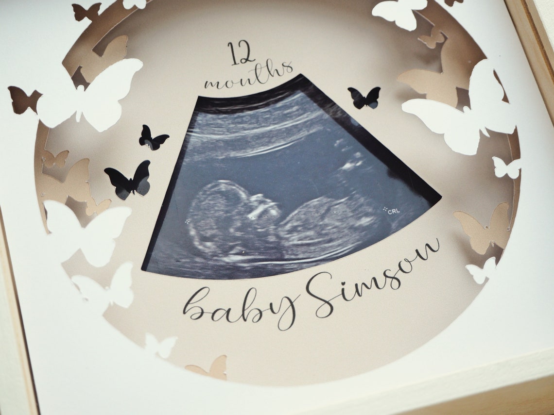 Baby Scan Photo Frame Template| Baby Ultrasound Picture Frame| Baby ...